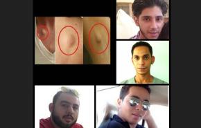 البحرين..معتقلو رأي يصابون بأمراض جديدة قد تكون سرطانية