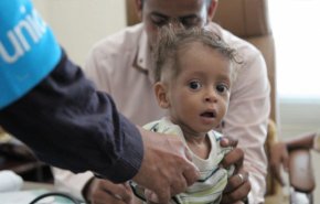 شاهد.. ارقام مرعبة تعلنها اليونسيف حول أطفال اليمن