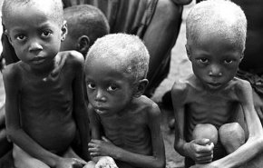 سُوء التغذية يُودي بحياة (120) طفلا يوميا في السودان