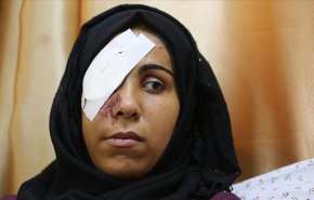شابة فلسطينية تروي كيف أفقدها الاحتلال عينها؟
