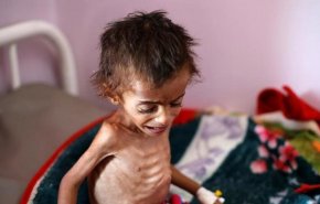 مسؤول أممي يحذّر من خطر مجاعة جديد في اليمن
