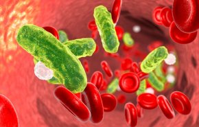 'الإنتان' مسؤول عن 20% من الوفيات بالعالم.. فما هو؟