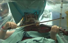 تحدٍ خارق ..العزف على الكمان أثناء الخضوع لجراحة دقيقة في المخ