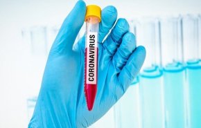 معهد ايراني یرفع طاقته لتشخيص فيروس كورونا الى 1200 اختبار يوميا