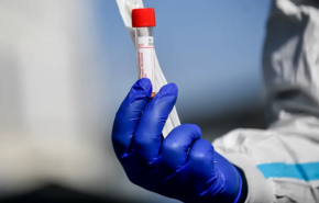  تسجيل 30 إصابة جديدة بفيروس كورونا في تونس