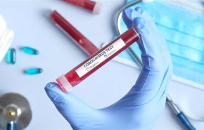 تسجيل 31 إصابة و47 حالة شفاء من كورونا في العراق