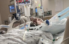 طبيب أمريكي: أجهزة التنفس قد تضر مرضى كورونا