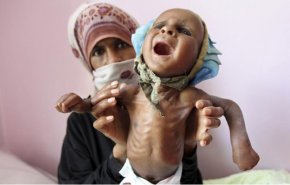 شاهد: اطفال اليمن عرضة لعدد لا يحصى من المخاطر
