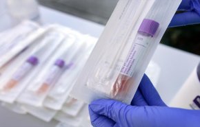 روسيا تحتل المرتبة الثانية في عدد فحوصات التاجي