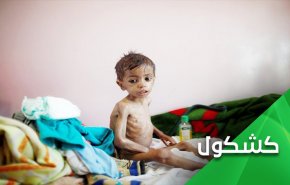 اليمن بلا نظام صحي.. وإبن سلمان يتحالف مع كورونا