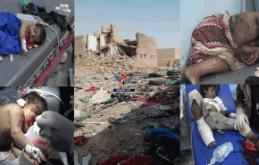 حكومة صنعاء تدين مجزرة الجوف وتعتبرها جريمة حرب
