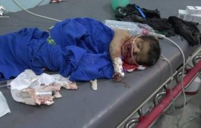 الصحة اليمنية تدين مجزرة العدوان بحق المدنيين في الجوف