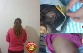 بالصور.. امرأة في جبلة تعذب طفلي زوجها بوحشية