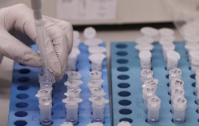 حصيلة فيروس كورونا في أمريكا...اليكم آخر الارقام