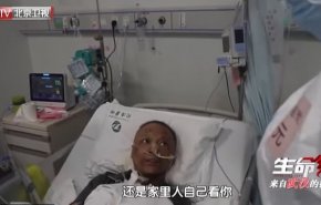 بالفيديو..طبيب صينى يستعيد لون بشرته بعد تغيرها بسبب علاج لفيروس كورونا 