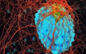  تقنية جديدة تنجح في قتل الخلايا السرطانية