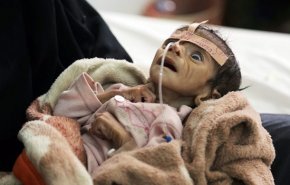 شاهد .. الأمم المتحدة تحذر من كارثة انسانية في اليمن