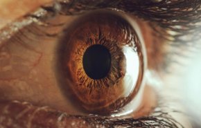 علامات بالعين قد تدل على احتمال الإصابة بمرض مميت!
