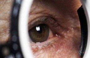  أعراض تصيب العين تكشف عن الإصابة بسرطان الرئة
