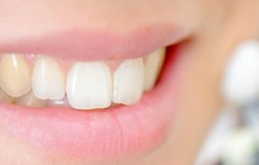 6 طرق للتخلص من اصفرار الاسنان.. دون الحاجة للإنفاق