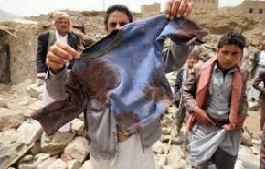 سکوت جامعه جهانی ظلم به مردم یمن است 