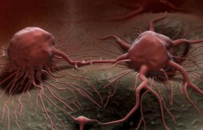 كيف تهرب الخلايا السرطانية من العلاج الكيميائي وتكرار الإصابة؟