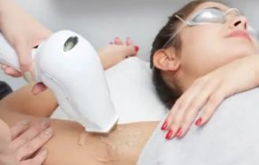 أضرار غير مألوفة لتقنية إزالة الشعر بالليزر
