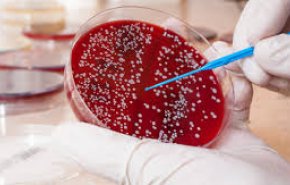 طريقة سهلة للكشف عن سرطان الدم في مرحلة مبكرة
