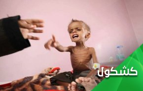 غوتيريش.. ومحاولة غسل يد إبن سلمان من دماء أطفال اليمن