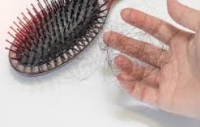 4 علاجات طبيعية تحمي من تساقط الشعر