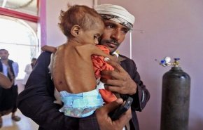 مرعب: طفل يمني يموت كل عشر دقائق نتيجة الجوع والأمراض