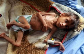 شاهد..أطفال اليمن حقوق منتهكة وحياة مسلوبة