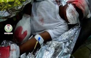 إصابة طفلين يمنيين بانفجار قنبلة عنقودية في صعدة