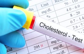 ما هو الكوليسترول “الجيد” و”السيء”؟ وما هي علامات ارتفاعه؟