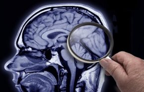 دراسة خطيرة تكشف تأثير كورونا على المخ والذاكرة