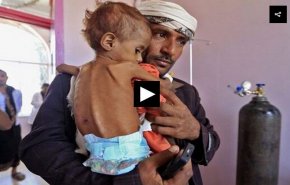 مقام یمنی در گفت وگو با العالم: هر 10 دقیقه یک کودک یمنی می‌میرد