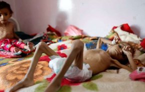 صنعاء تدين استمرار الحصار وسياسة العقاب الجماعي بحق الشعب اليمني