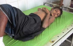 نزدیک به 4 هزار شهید و  مجروح بر اثر بمب های خوشه ای از آغاز تجاوز به یمن
