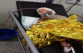 إصابة ثلاثة أطفال يمنيين بانفجار قنبلة من مخلفات العدوان في حجة