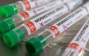 بررسی موارد مشکوک آبله میمونی در ۱۲ قطب دانشگاهی/ درخواست خرید واکسن علیه این بیماری
