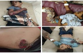 اليمن.. 11 ضحية بينهم 10 أطفال جراء القنابل العنقودية ومخلفات العدوان