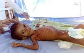 یمن در محاصره؛ 6 میلیون کودک در خطر گرسنگی منجر به مرگ  هستند
