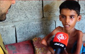 في ظل استمرار الحصار.. اطفال اليمن على سرير الموت