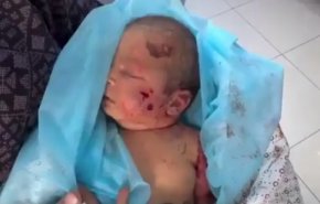 شهادت نوزاد 11 روزه فلسطینی در حملات اشغالگران