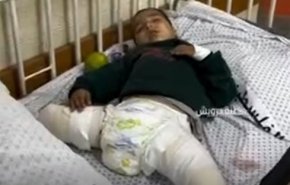 کودک فلسطینی که براثر بمباران خانه اش دو پای خود را از داده است+ ویدیو