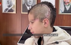 کوچک ترین اسیر فلسطینی که اشغالگران جمجمه اش را خُرد کردند+ فیلم 