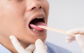 اذا شاهدت هذه الأعراض فانت مصاب بسرطان الفم!