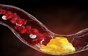 صعود السلالم.. حركة بسيطة تعزز صحة القلب وتطيل العمر