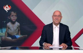 الجوع يفتك بأبناء غزة