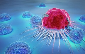  تطوير تقنية محلية لإيصال الخلايا العلاجية بدقة إلى موقع الورم